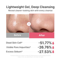 Thumbnail for Image 4 of medicube PDRN Pore Care Duo - PDRN Cleansing Oil & Face Scraper