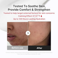Thumbnail for Image 4 of medicube Comforting Serum & Cream Duo Ideal for After Spot Care