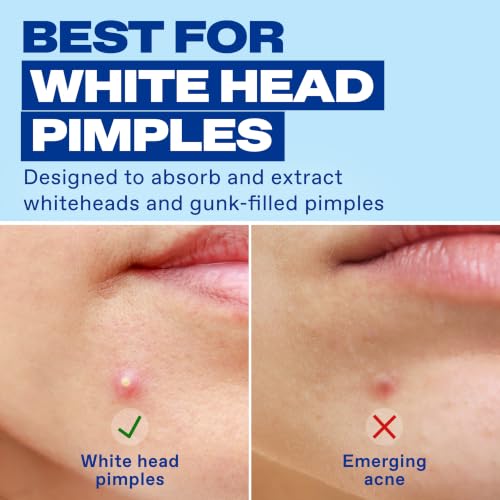 Image 3 of Differin Power Pimple Patches, Hydrocolloid Acne Treatment, 23ct