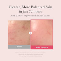 Thumbnail for Image 3 of medicube Ultimate Clear Glass Skin Serum Duo - TXA and PDRN Serum
